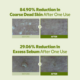 6-Ceramide Complex strengthens barrier while keeping skin hydrated after exfoliation.