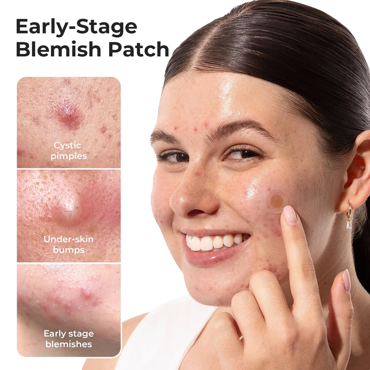 TKTK 265 patch spread over blemish for deep, visible action.
