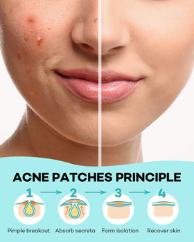 TKTK pimple patch hydrocolloid texture shows skin-friendly, breathable material.