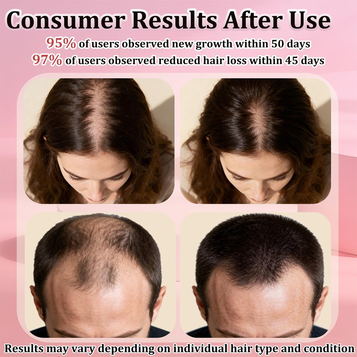 TNEGHC minoxidil spray side view showing comfortable grip for daily use