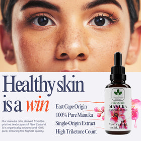 TODICAMP Manuka Oil dropper close-up highlighting undiluted oil for precise application.