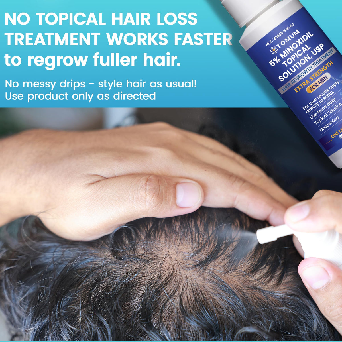 Tomum minoxidil spray disperses quickly with fast absorption