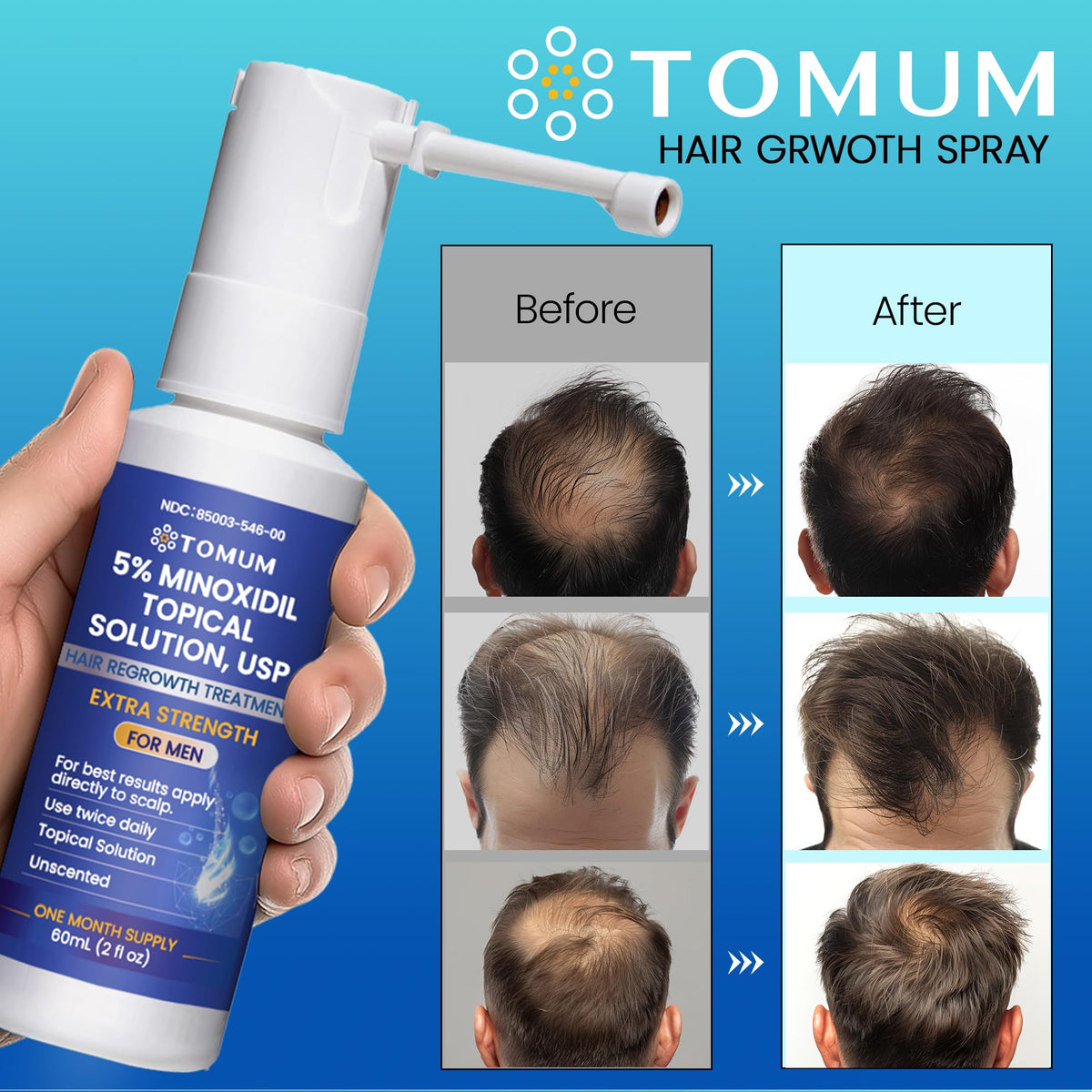 Tomum minoxidil spray bottle beside USA-made label