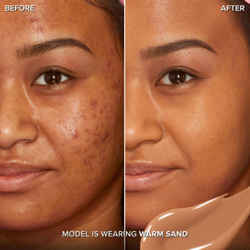 Too Faced Born This Way concealer applying tiny dots demonstrates precise blending.