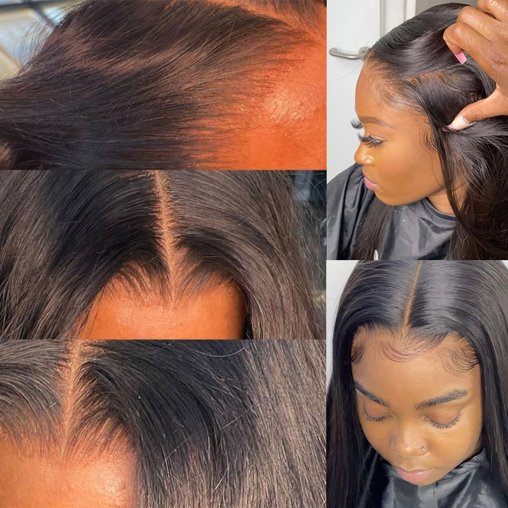 Versatile 6x6 lace closure by Topnormantic for natural looks and easy styling.