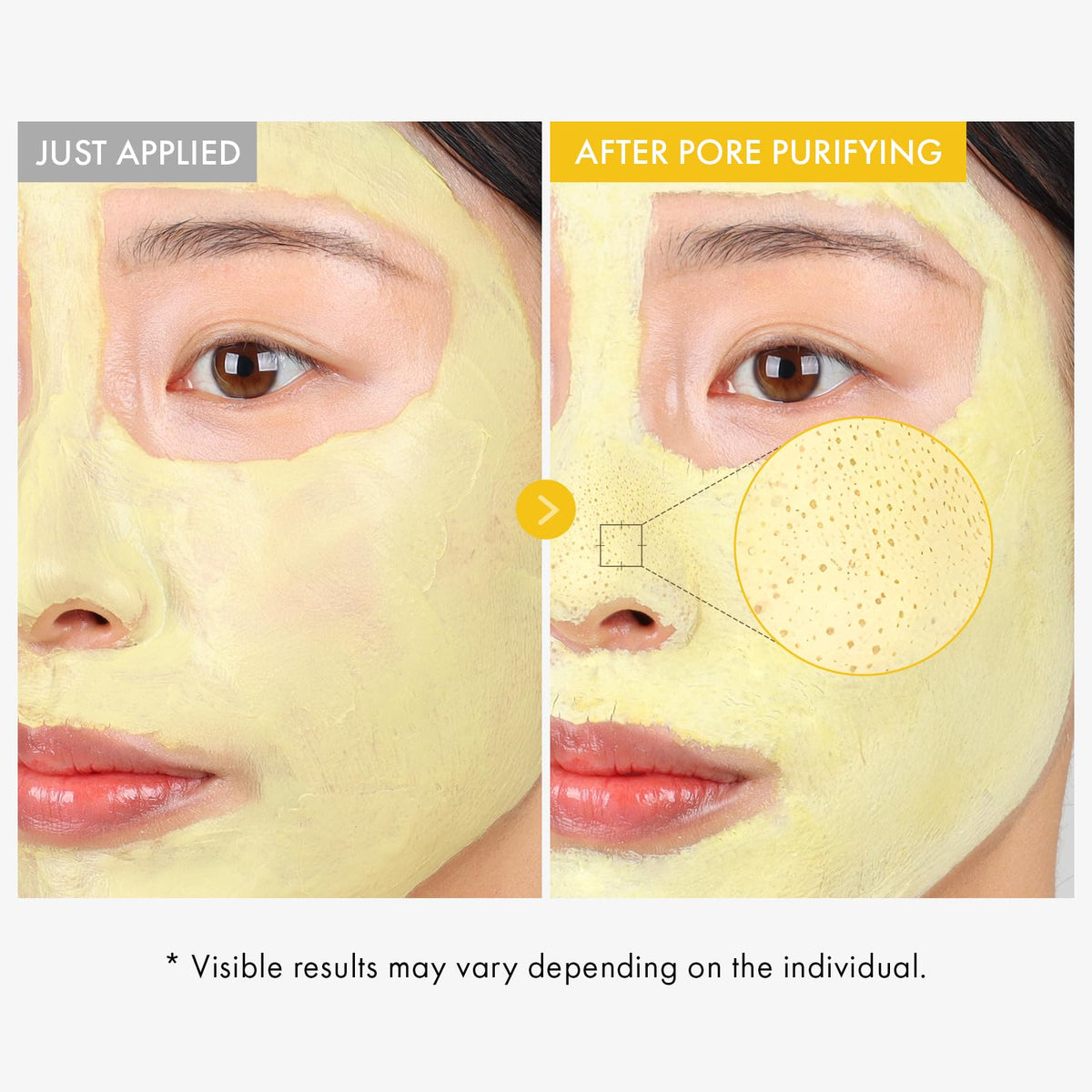 TOSOWOONG Kojic mud mask on face offers cooling relief while purifying pores.