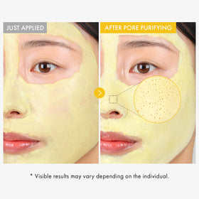 TOSOWOONG Kojic mud mask on face offers cooling relief while purifying pores.