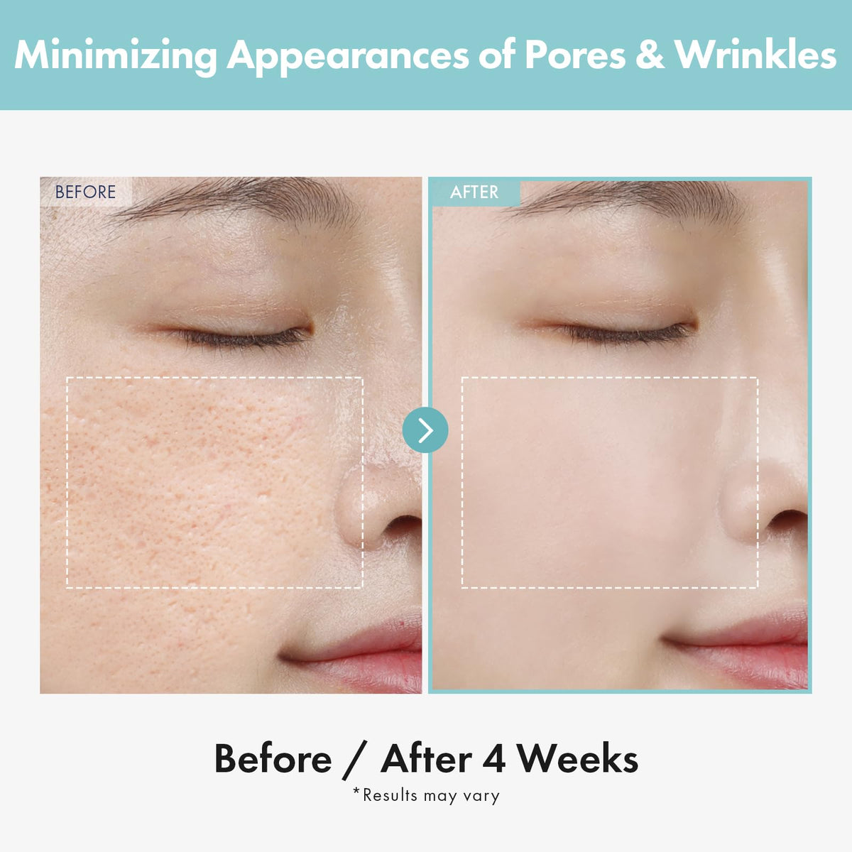 TOSOWOONG Pore Refiner Cream pore-minimization visual demonstrates refined pores and balanced oil