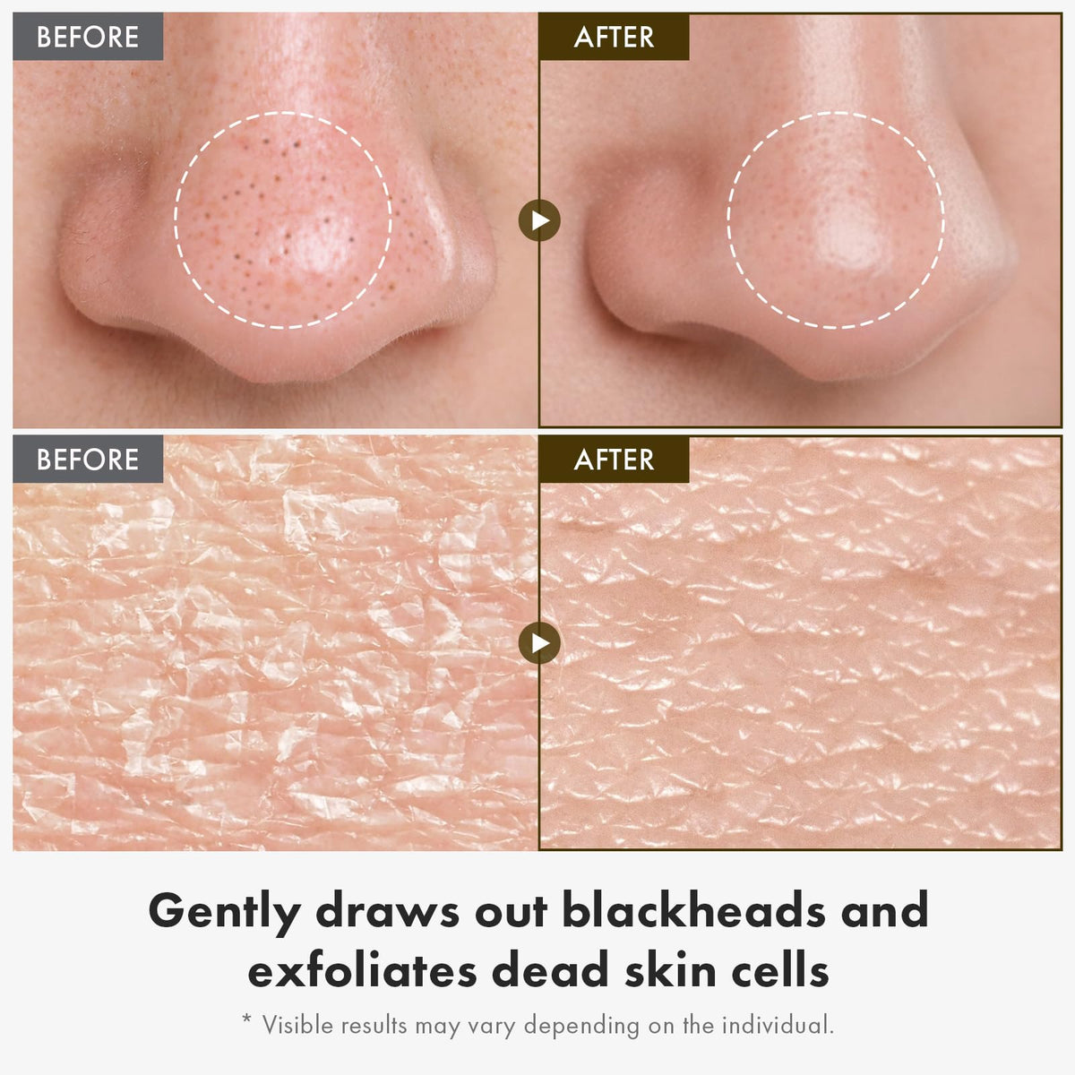 TOSOWOONG White Rice Peeling Ampoule texture close-up for smoother skin