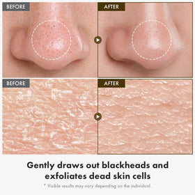 TOSOWOONG White Rice Peeling Ampoule texture close-up for smoother skin