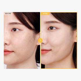 TOSOWOONG 8 Days Spot Cream ingredients list featuring hyaluronic acid and niacinamide