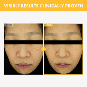 TOSOWOONG 8 Days Spot Cream swatch illustrating the creamy texture and color