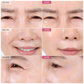TOSOWOONG eye-area patch providing gentle hydration for delicate skin