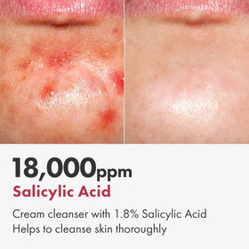 TOSOWOONG Centella extract soothing skin close-up