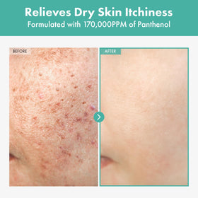 Tosowoong Dexpanthenol Cream bottle front highlighting soothing barrier-supporting benefits