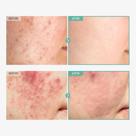 Tosowoong Dexpanthenol Cream texture swatch emphasizes lightweight hydration