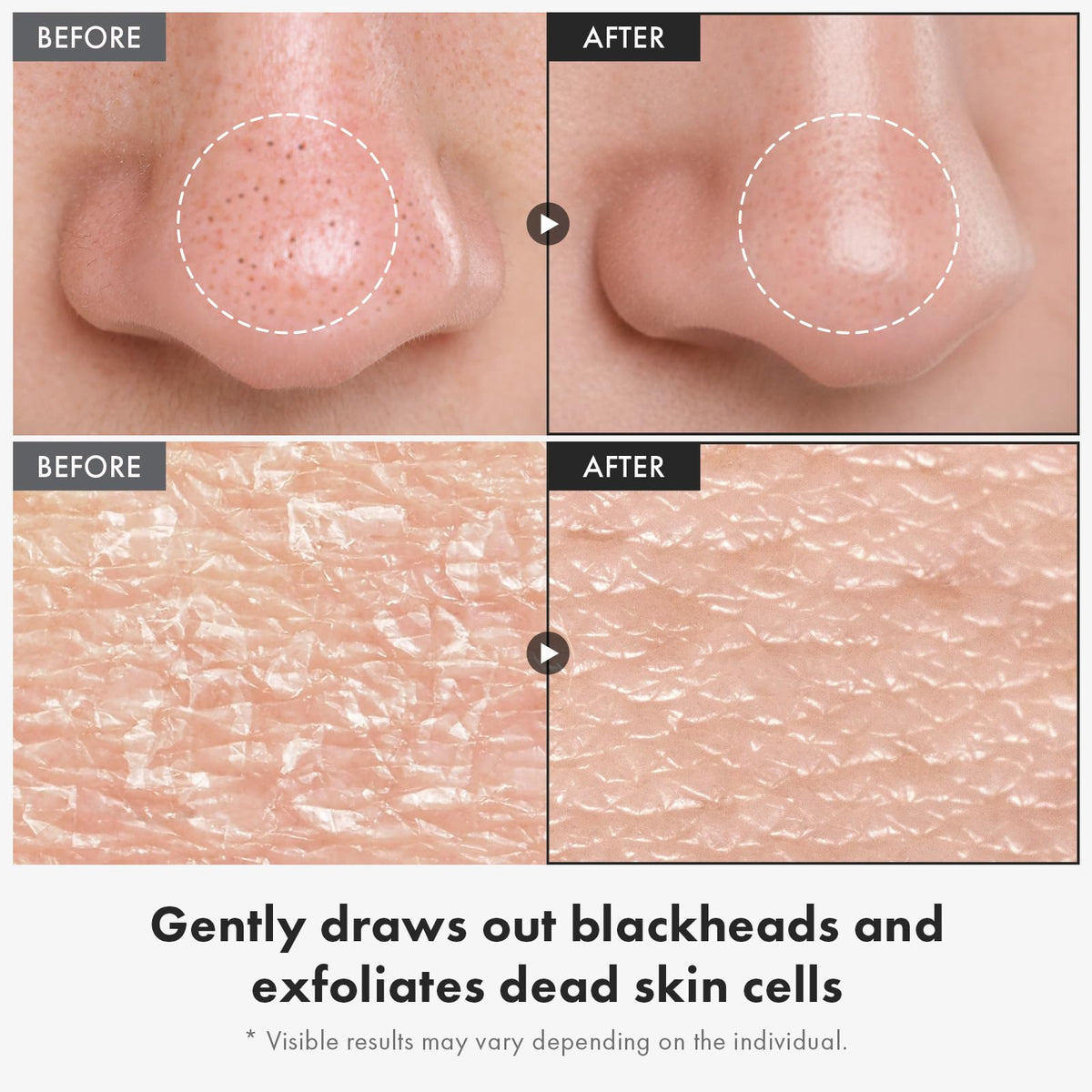 TOSOWOONG exfoliating peel liquid texture close-up