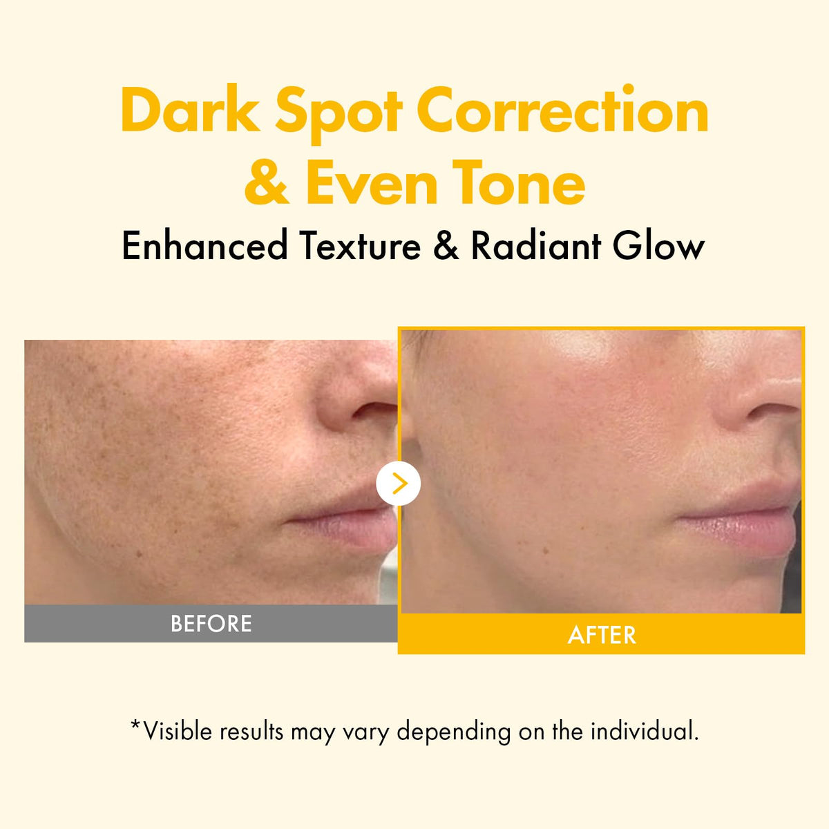 TOSOWOONG Kojic Acid Turmeric Overnight Wrap Mask texture closeup highlights potent actives.