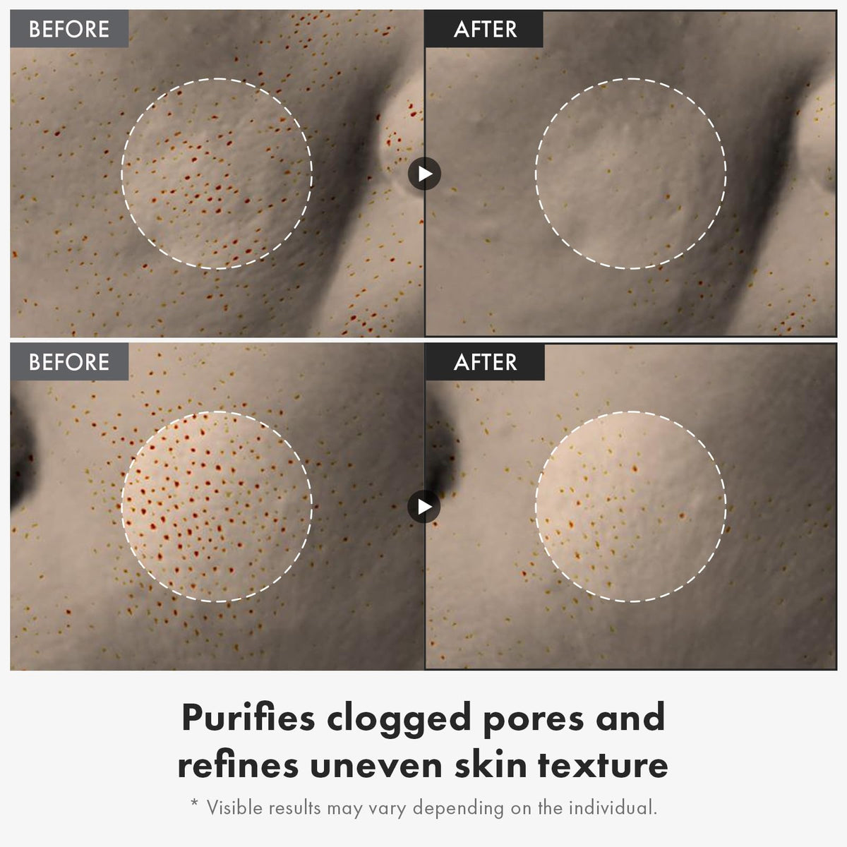 TOSOWOONG Kojic acid arbutin clarity close-up