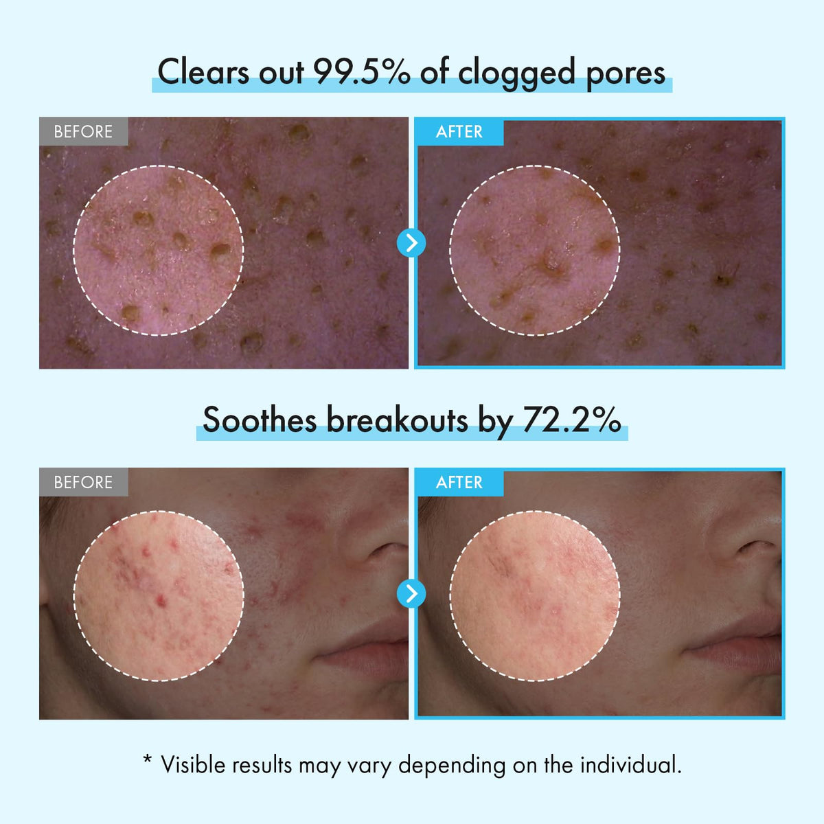 TOSOWOONG Niacinamide for calm, balanced skin and pores.