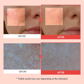 Label view of TOSOWOONG Real Mandelic Acid Cream highlights mandelic acid and Niacinamide