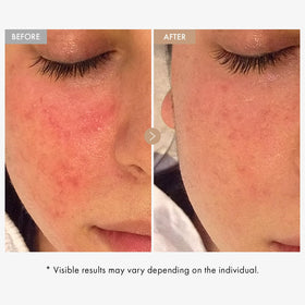 TOSOWOONG Real Oatmeal Relief Cream application on hand demonstrates easy daily moisturizing.