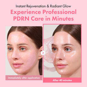 TOSOWOONG Real Pink PDRN Fit mask color-change indicating moisture absorption and glow.