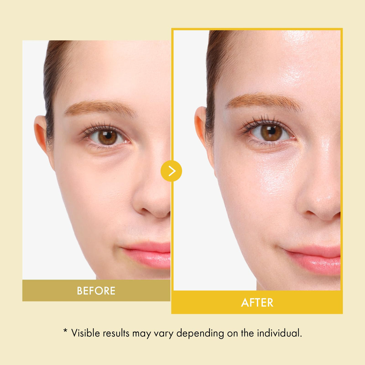 TOSOWOONG Rice Glow Spray Serum applying on skin for instant hydration.