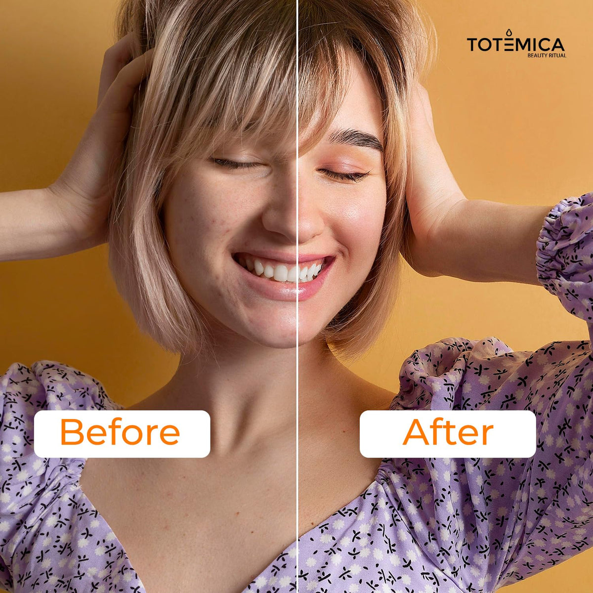 Totemica Vitamin C Serum routine step integrated into daily skincare.