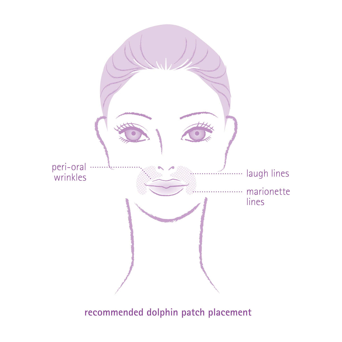 Toute Nuit dolphin patch offers comfortable overnight wear on the mouth area.