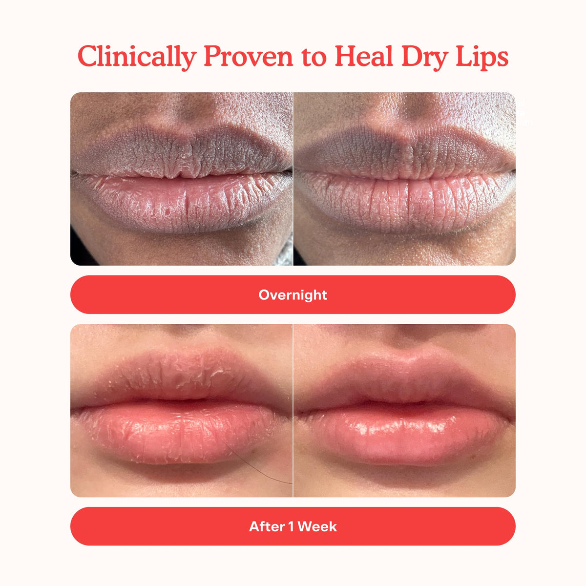 Tower 28 LipSoftie overnight hydration mask on lips