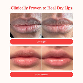 Tower 28 LipSoftie overnight hydration mask on lips
