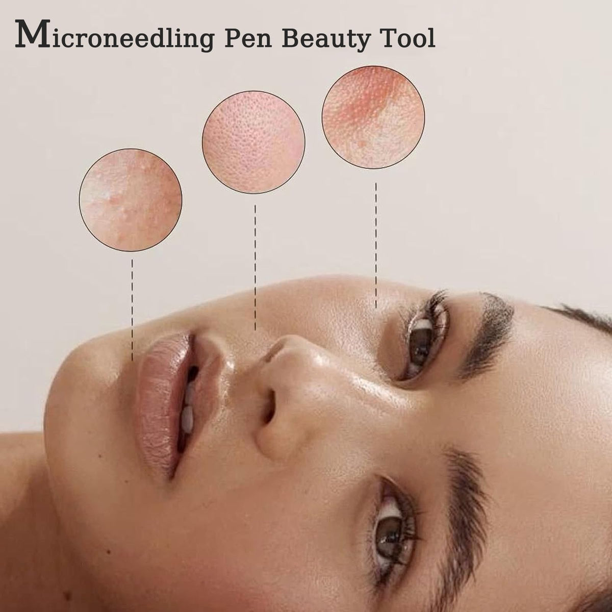 TrDLam Derma Roller Pen used on face for gentle at-home skin care.