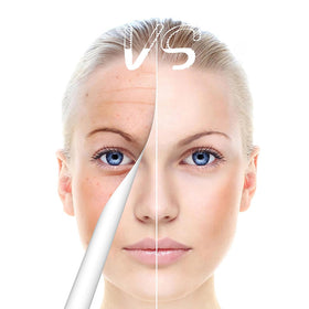 TrDLam Derma Roller Pen for hair care in routine use.