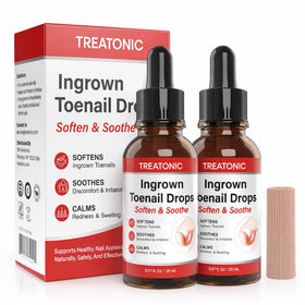 Treatonic ingrown toenail drops bottle shown for at-home softening and relief