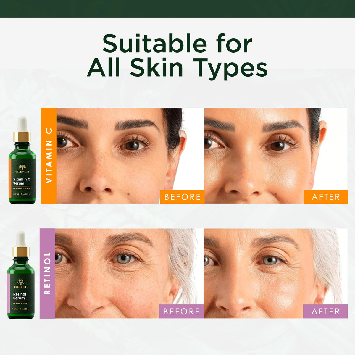 Tree of Life Beauty Niacinamide Serum helps minimize pores and clarify skin.