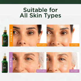 Tree of Life Beauty Niacinamide Serum helps minimize pores and clarify skin.