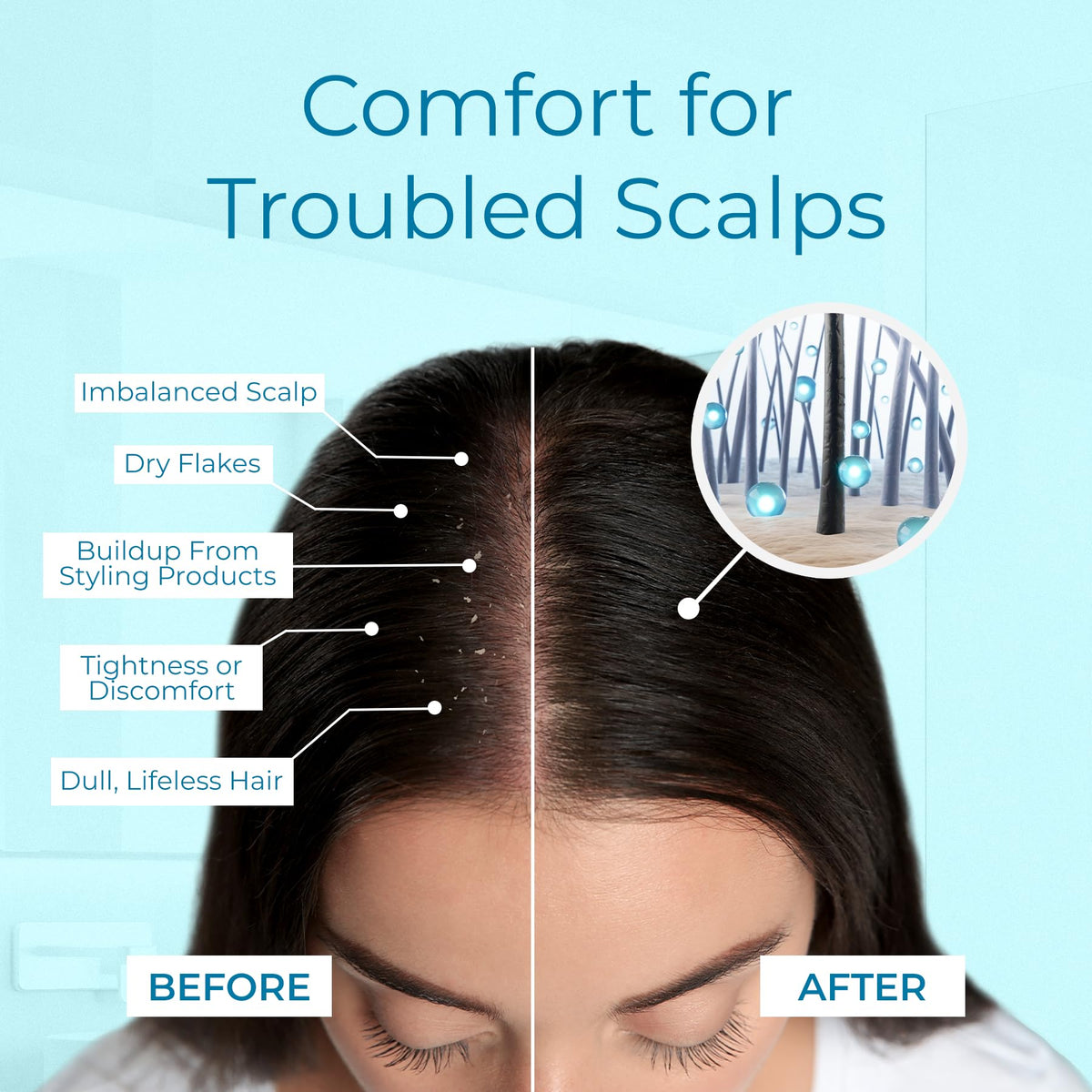 Tree To Tub menthol cooling from dry scalp spray for relief