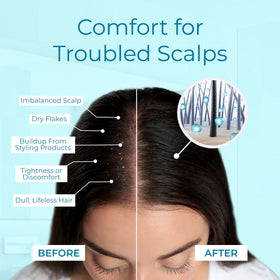 Tree To Tub menthol cooling from dry scalp spray for relief