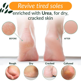 Tree To Tub Foot Cream application on foot, soothing exfoliation