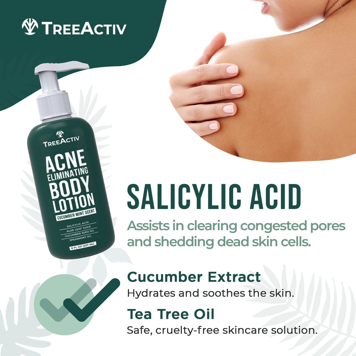 TreeActiv Acne Eliminating Body Lotion with aloe vera emphasizes soothing hydration