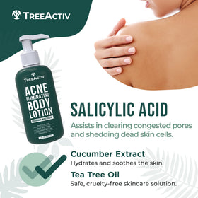TreeActiv Acne Eliminating Body Lotion with aloe vera emphasizes soothing hydration