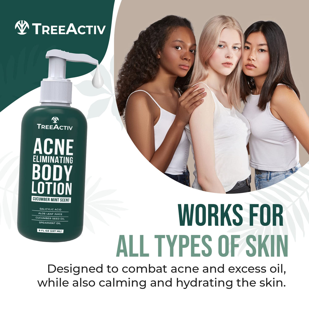 TreeActiv Acne Eliminating Body Lotion texture demonstrates easy rub-in and quick absorption