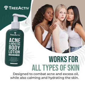 TreeActiv Acne Eliminating Body Lotion texture demonstrates easy rub-in and quick absorption