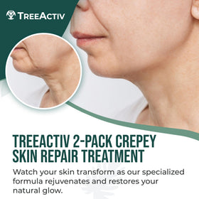 TreeActiv Crepey Skin Cream texture close-up showing silky formula for smoother skin.
