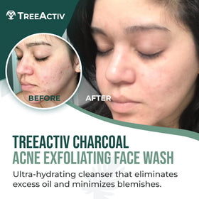 TreeActiv honey sulfur ingredients close-up highlight sebum balance and cleansing