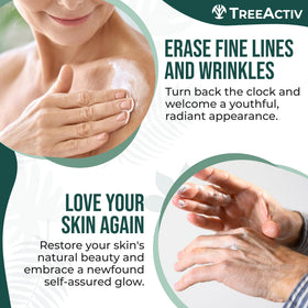TreeActiv Hyaluronic Acid Rich Cream close-up highlighting deep hydration.