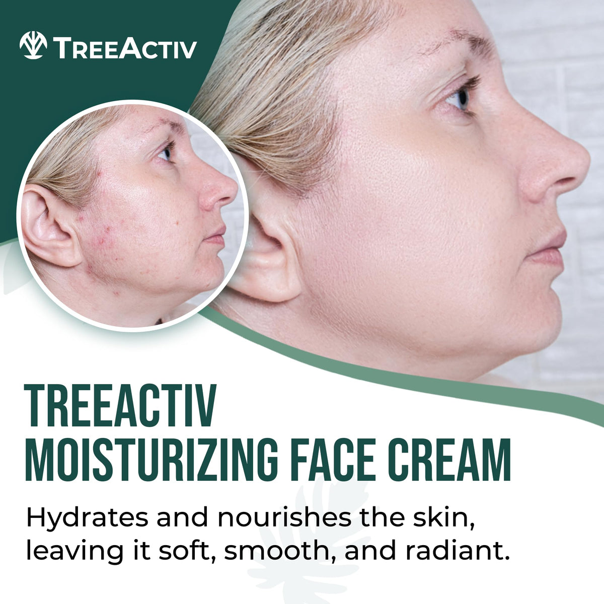 TreeActiv Tea Tree Moisturizing Formula texture close-up — lightweight, non-greasy feel.