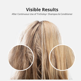 Tricholoy+ Gentle foam indicates sulfate-free, color-safe formula.