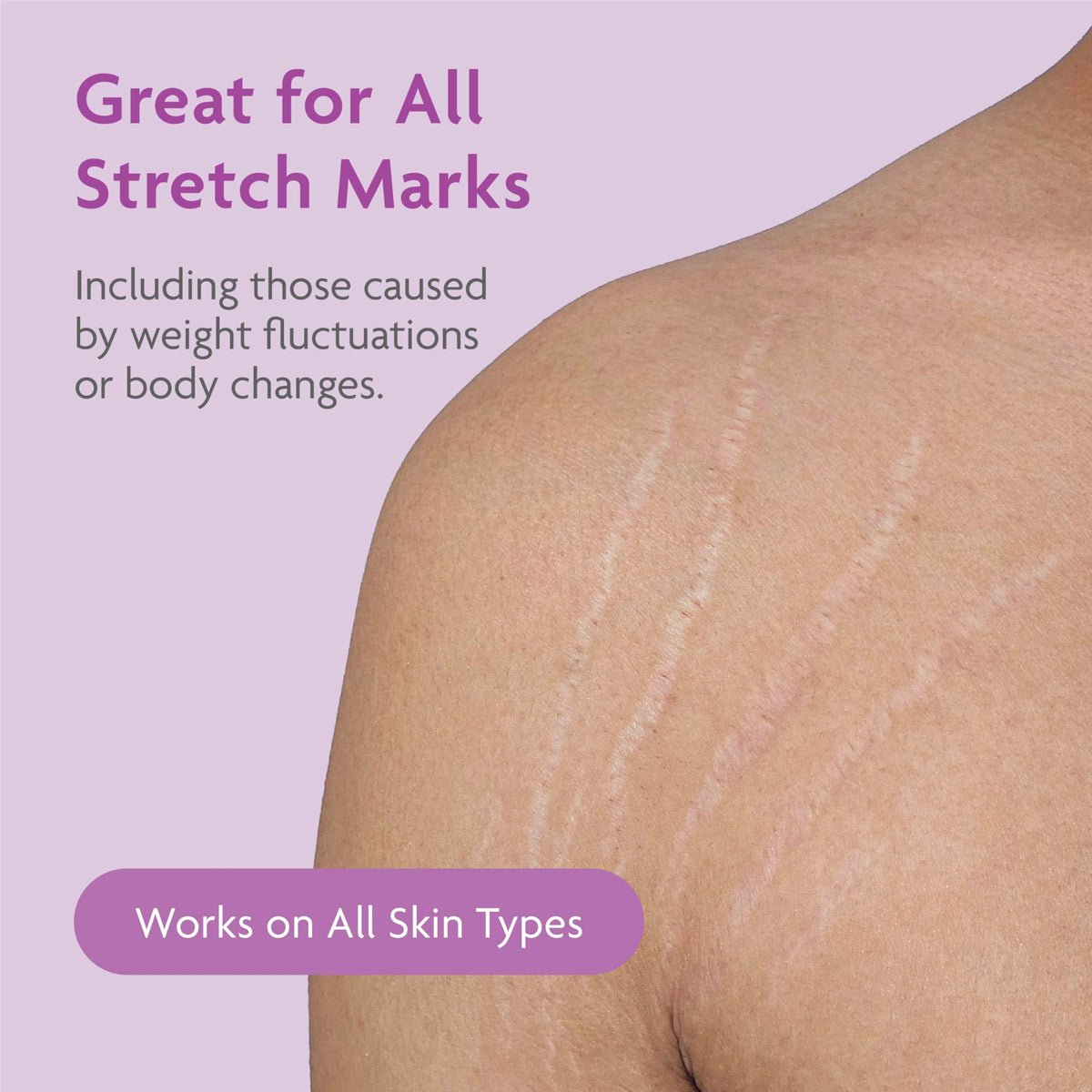 TriLASTIN skin hydration detail showing creamy texture.